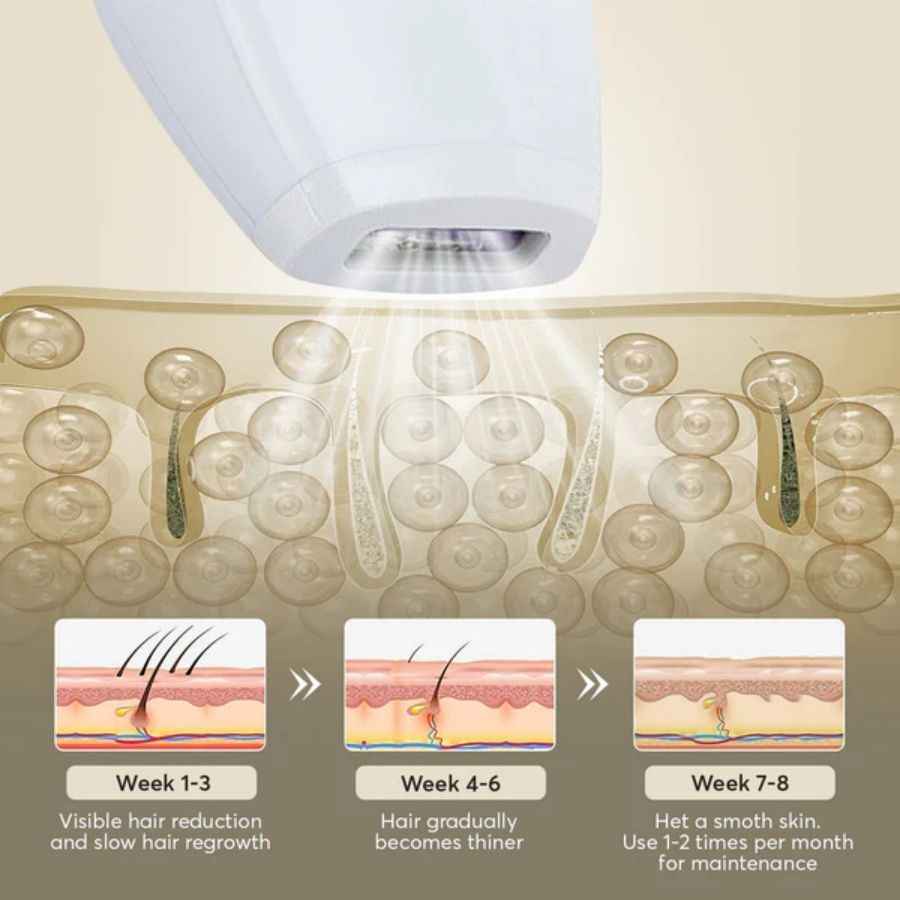 Professional Laser Epilator IPL Hair Removal Body Bikini Leg - Winima